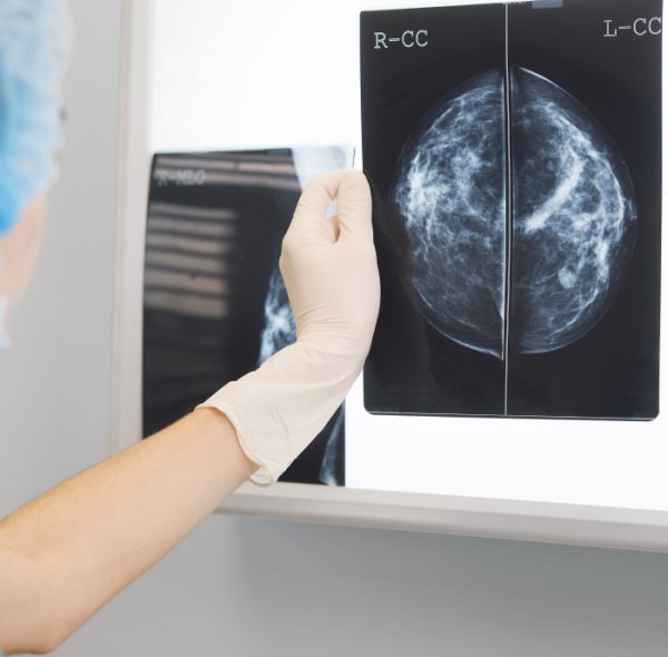 Mammography and Breast MRI: Can You Tell the Difference?