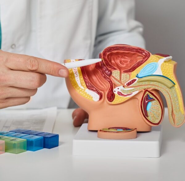 Prostate Cancer